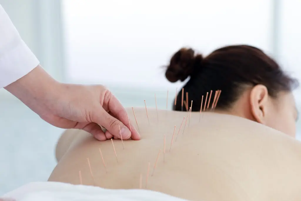 Can Acupuncture Improve IVF Success Rates?